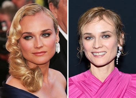 Diane Kruger Before and After Plastic Surgery: Boob,。